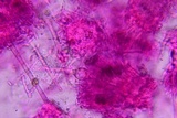 Pseudonectria buxi image