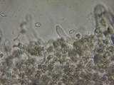Myxomphalia invita image