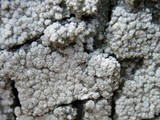 Pertusaria amara f. amara image