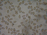 Inocybe leiocephala image