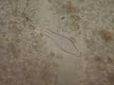 Inocybe leiocephala image