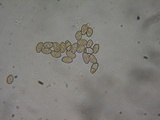 Inocybe leiocephala image