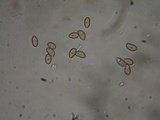 Inocybe leiocephala image