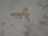 Inocybe leiocephala image
