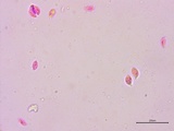 Clavulinopsis laeticolor image