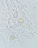 Leucocoprinus cepistipes image