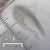 Megaspora verrucosa image