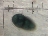 Rhizocarpon geographicum image