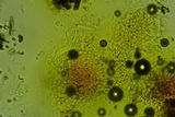 Byssosphaeria schiedermayeriana image