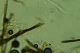 Byssosphaeria schiedermayeriana image