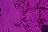 Byssosphaeria schiedermayeriana image