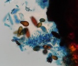 Sphaeropsis sapinea image