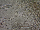 Rimbachia bryophila image