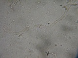 Rimbachia bryophila image