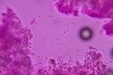 Athelia bombacina image