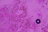Athelia bombacina image