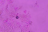Athelia bombacina image