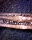 Rhizosphaera kalkhoffii image