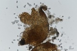 Rhizosphaera kalkhoffii image
