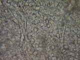 Stropharia coronilla image