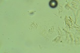 Rectipilus davidii image