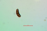 Buellia triseptata image