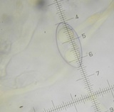 Octospora leucoloma image