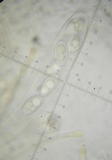 Octospora leucoloma image