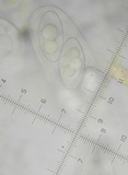 Octospora leucoloma image