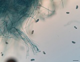 Dacryopinax elegans image