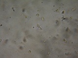 Rhodocybe aureicystidiata image