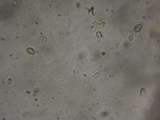 Rhodocybe aureicystidiata image