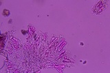Phanerochaete tuberculata image