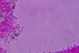 Phanerochaete tuberculata image
