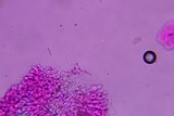 Phanerochaete tuberculata image
