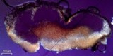 Trapeliopsis glaucopholis image