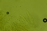Trichoderma citrinoviride image