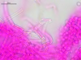 Athelia salicum image