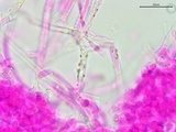 Athelia salicum image