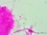Athelia salicum image