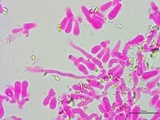 Athelia salicum image