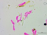 Athelia salicum image