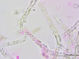 Athelia salicum image
