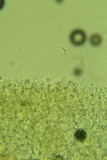 Sistotremastrum suecicum image