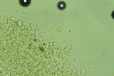 Sistotremastrum suecicum image