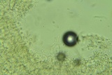 Sistotremastrum suecicum image