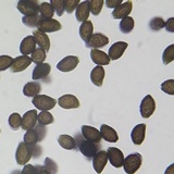Lacrymaria hypertropicalis image