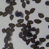 Lacrymaria hypertropicalis image