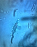 Diatrype virescens image