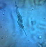 Diatrype virescens image